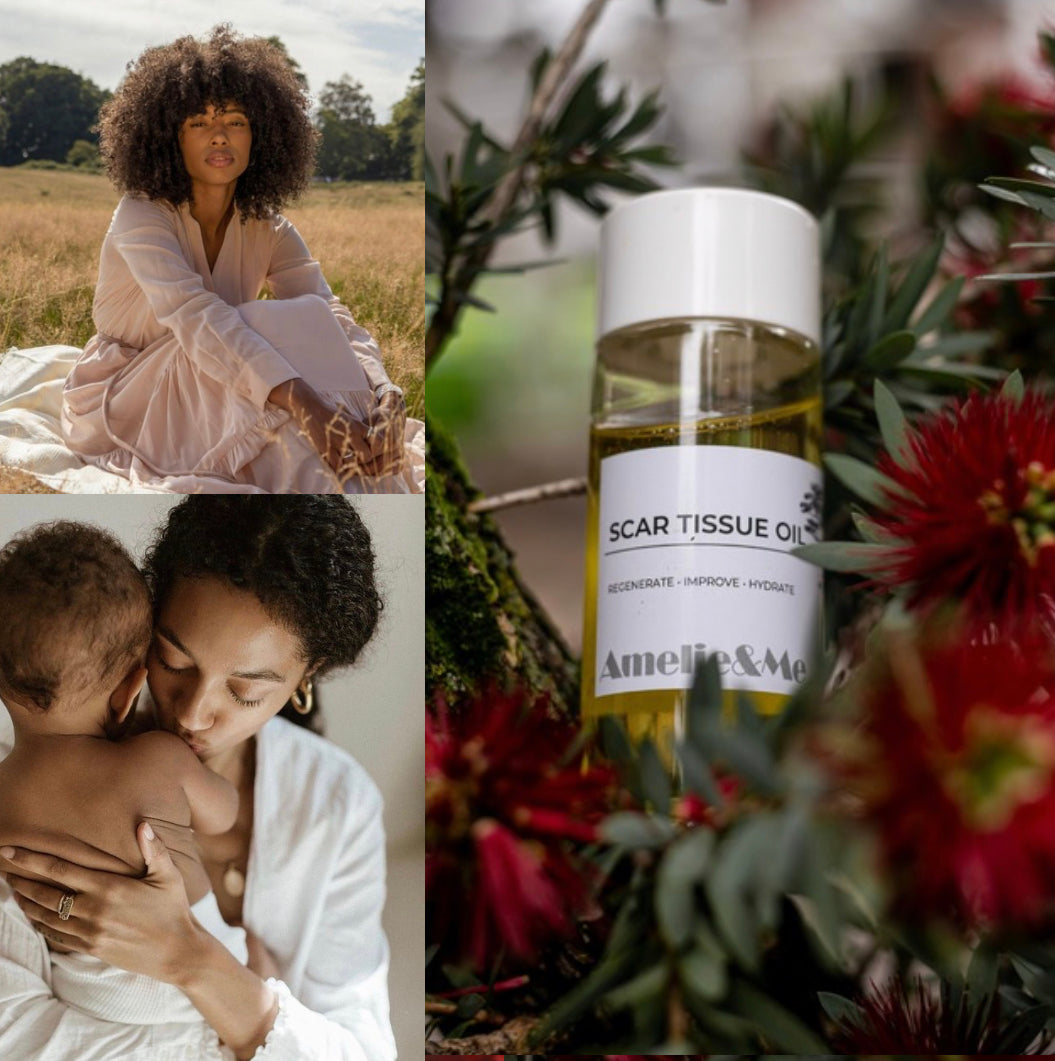 Scar Recovery Tissue Oil